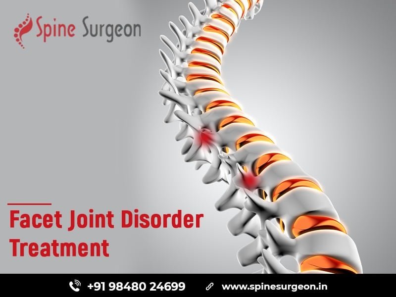 Facet Joint Disorder Treatment