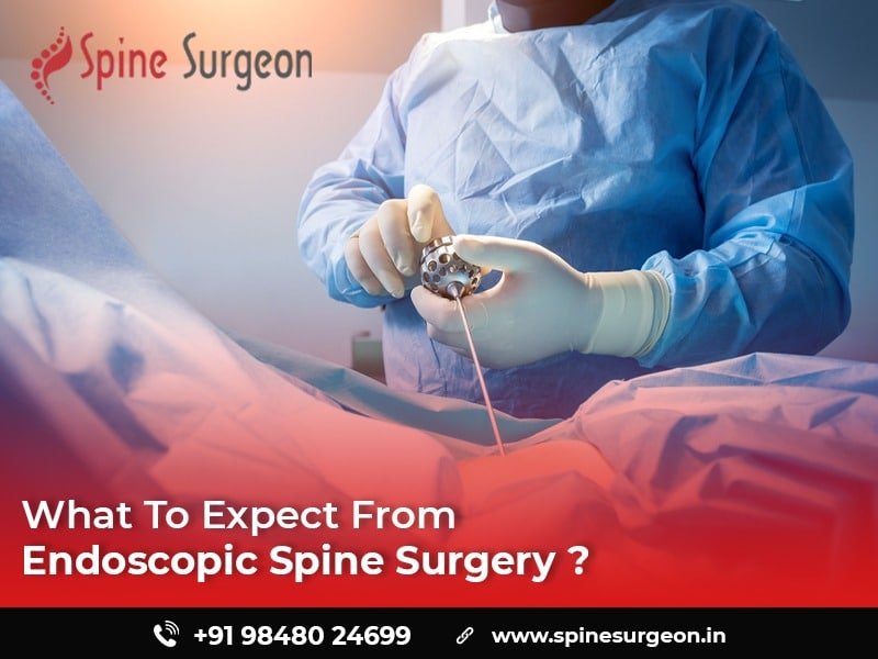 What to Expect from Endoscopic Spine Surgery?